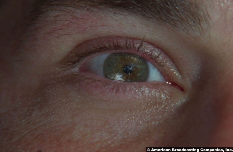 Lost S01e01 Matthew Fox Jack Shephard Eye