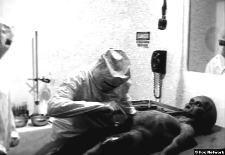 Fox Alien Autopsy 1995